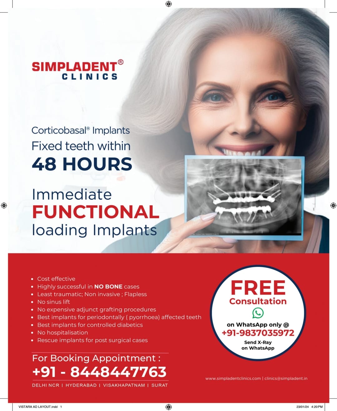 Simpladent Sparks Nationwide Smiles: Immediate Loading Dental Implants to Soon Reach Every City!