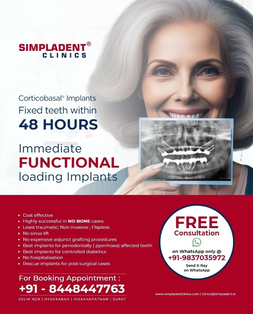 Simpladent: Transforming Smiles Across India with Revolutionary Immediate Loading Dental Implants